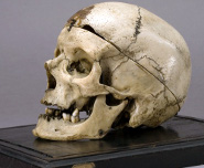 Cranio Villella1