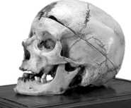Motta_S._Lucia_Cranio_Villella