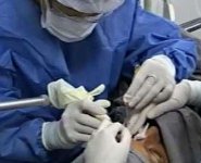 Occhi operazione