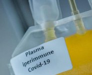 Plasma iperimmune