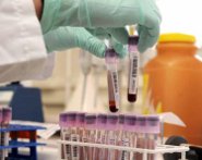 Plasma sangue boccetta