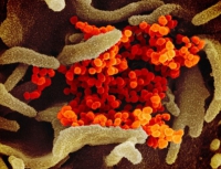 Coronavirus, in via di sviluppo un vaccino "jolly" contro future pandemie