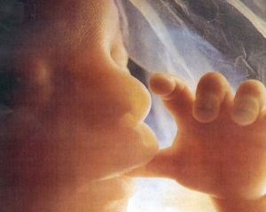 La ricerca, trovate per la prima volta microplastiche nella placenta umana