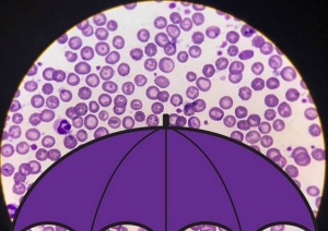 I virus piovono dal cielo, centinaia di milioni a metro quadro