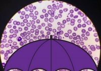 I virus piovono dal cielo, centinaia di milioni a metro quadro