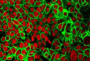 La dieta povera di grassi affama i tumori