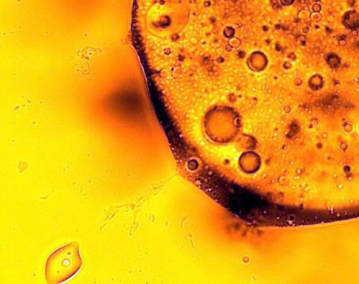 Potenziale elisir di giovinezza nei batteri intestinali