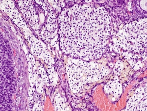 Scoperto un nuovo organo nel corpo umano: l'interstizio