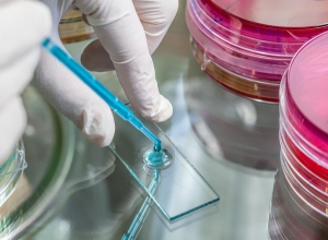 Approvato farmaco per la Tbc resistente, funziona nel 90% casi