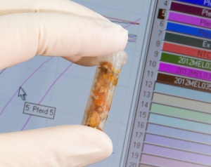 I super antibiotici riducono la mortalità dal 50% al 10%